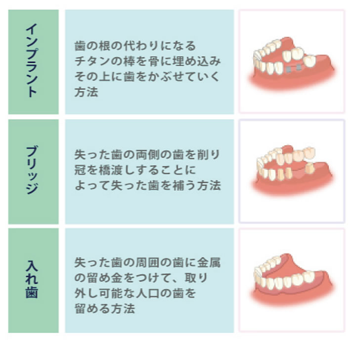 他の治療法との比較