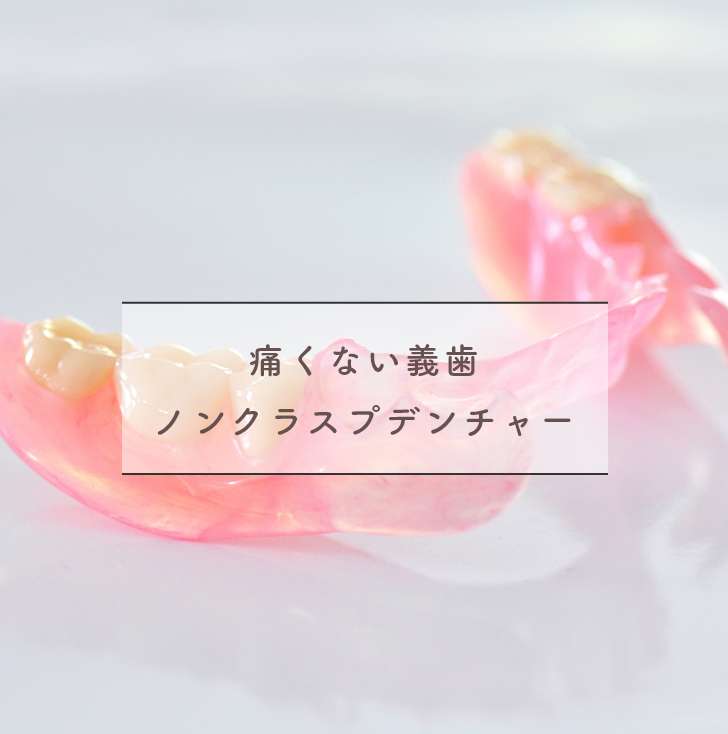 痛くない義歯ノンクラスプデンチャー