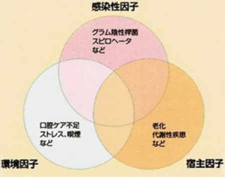 歯周病の原因と進行について