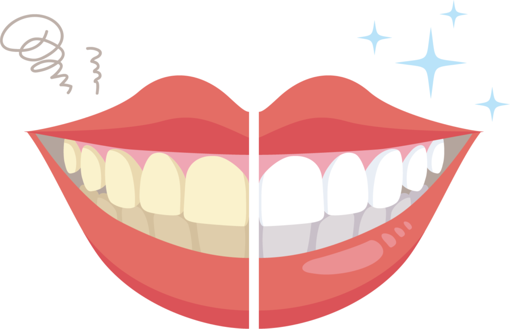 加齢で歯が黄ばむのはなぜ？歯を白くする方法を解説！ - しろくま歯科医院